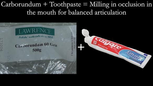 Newsletter 57 showcases the making and fitting process of implant-supported complete dentures for Alisdair