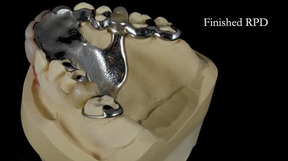 Newsletter 81 - Pam’s Story — how a partial denture changed her life (+ live walkthrough this Thursday)