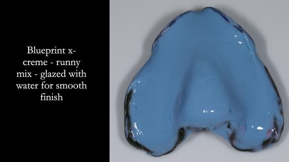 Newsletter 77: Jeremy’s case – immediate complete upper denture