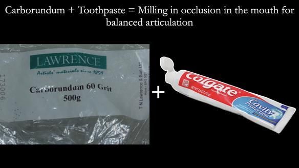Newsletter 78: What do Clark Gable and a Locator® overdenture have in common?