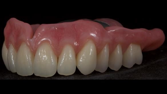 Newsletter 79 – Creating a wonderful smile and changing a life.