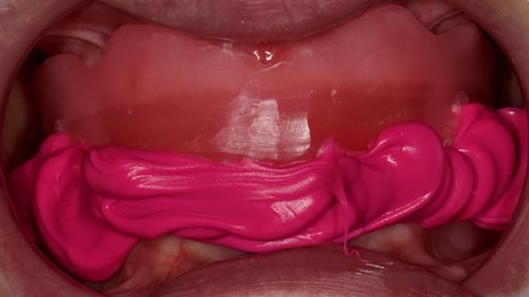 Newsletter 79 – Creating a wonderful smile and changing a life.