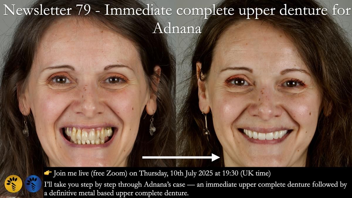 Newsletter 79 – Creating a wonderful smile and changing a life.