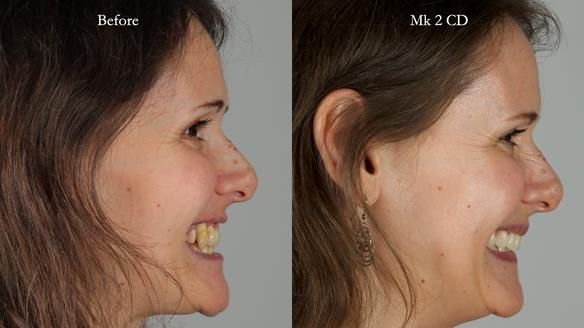 Newsletter 79 – Creating a wonderful smile and changing a life.