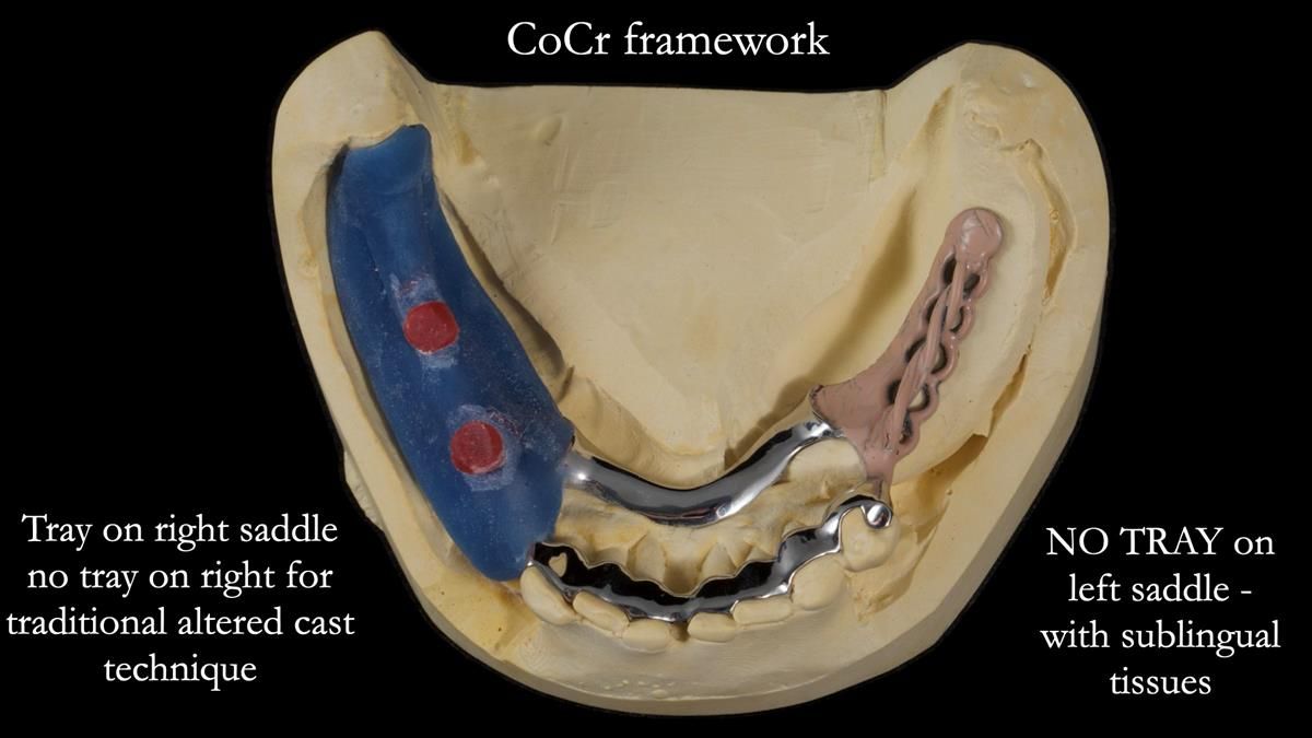 Newsletter 87 – Father Peter: A Partial Denture that needed Minor Miracle
