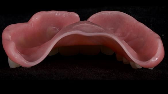 Newsletter 79 – Creating a wonderful smile and changing a life.