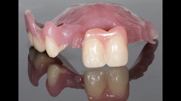 Newsletter 79 – Creating a wonderful smile and changing a life.