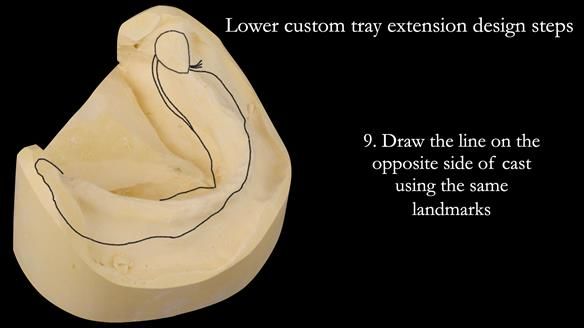 Newsletter 50 Special edition Complete Dentures FULL PROTOCOL