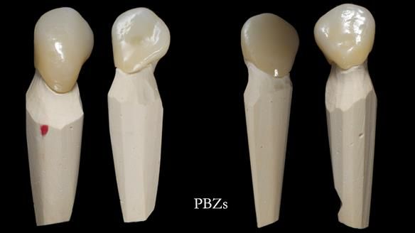 Newsletter 81 - Pam’s Story — how a partial denture changed her life (+ live walkthrough this Thursday)