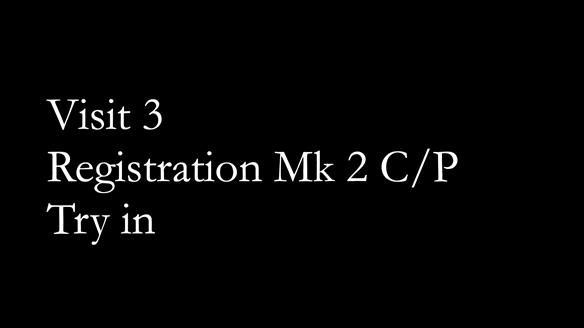 Newsletter 52 Managing Jo’s failing dentition with extractions and Mk 1/Mk 2 complete upper dentures and lower partial dentures FULL PROTOCOL