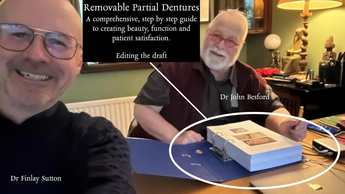 Newsletter 76: Jackie’s case – Telescopic overdenture & precision RPD (the tricky truth!)