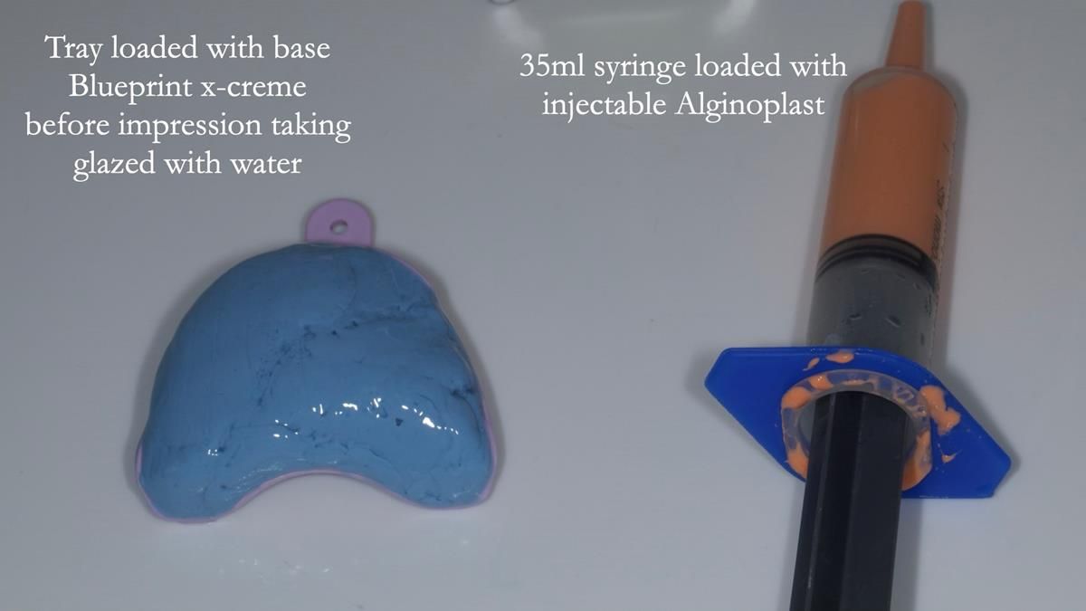 Fin’s Newsletter 88 — Complete dentures - full protocol… he rearranged his own teeth!