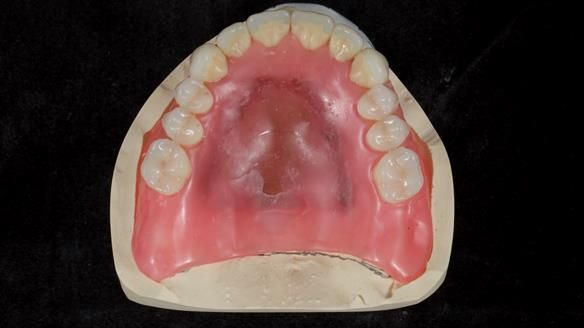 Newsletter 79 – Creating a wonderful smile and changing a life.