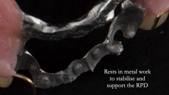 Ken – going downhill, first class