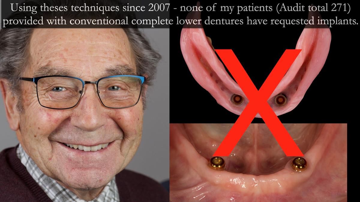 Newsletter 50 Special edition Complete Dentures FULL PROTOCOL