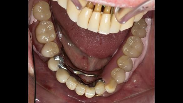 Ken – going downhill, first class