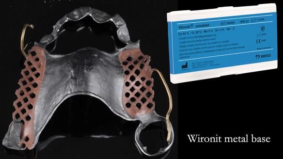 Finlay's Newsletter 60 Sylvia's upper Kennedy Class 2 Mod 1 metal based upper RPD