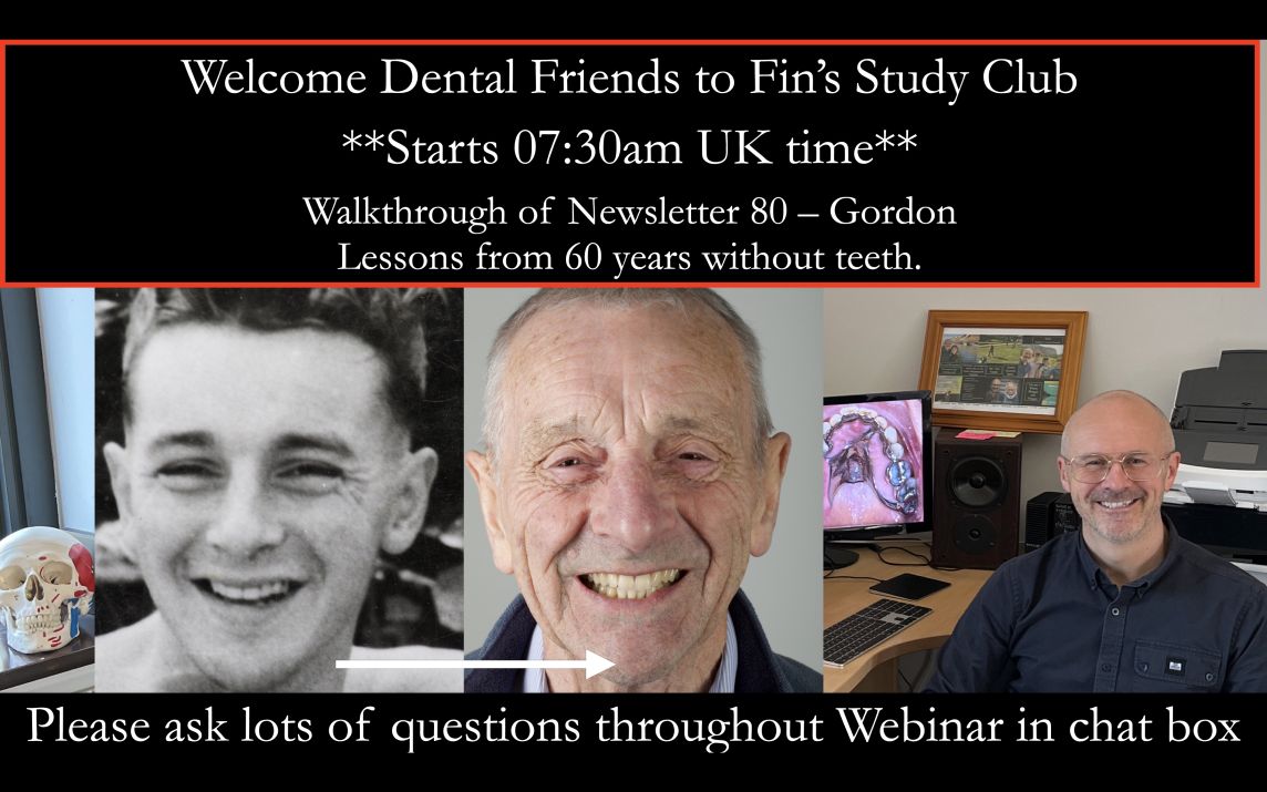 Gordon’s Complete Denture Journey: Lessons from 60 Years Without Teeth