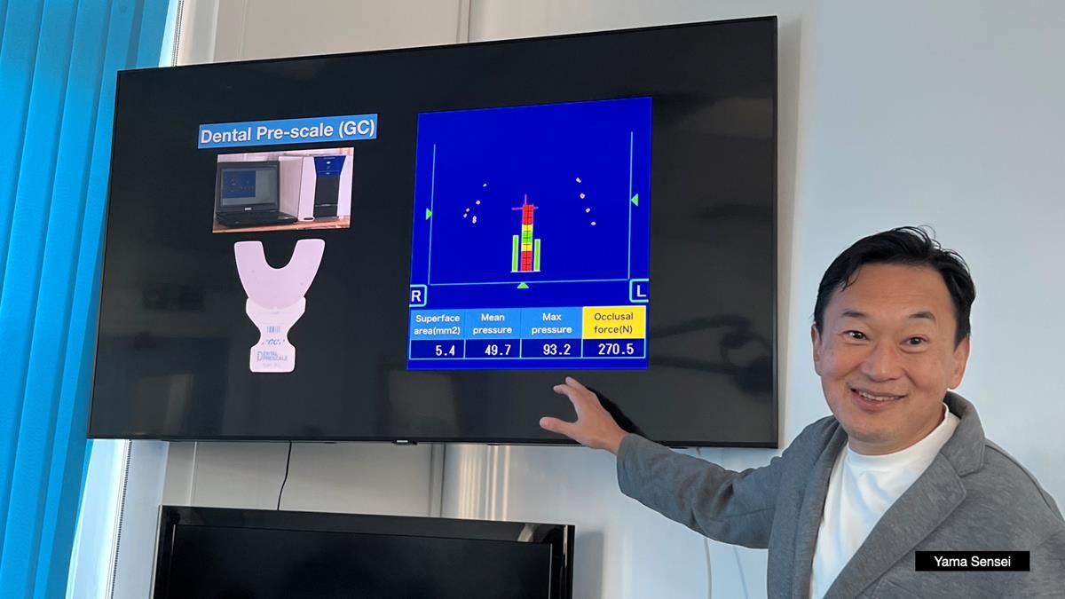 Finlay's Newsletter 60 Sylvia's upper Kennedy Class 2 Mod 1 metal based upper RPD