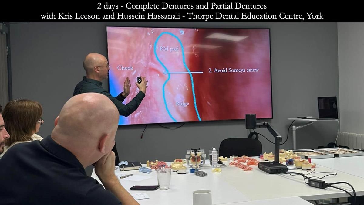 Newsletter 57 showcases the making and fitting process of implant-supported complete dentures for Alisdair