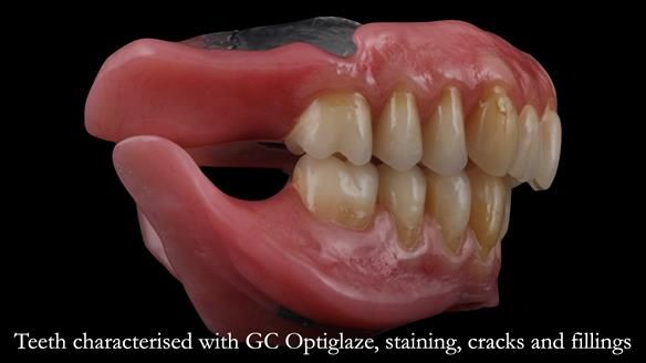 Newsletter 50 Special edition Complete Dentures FULL PROTOCOL