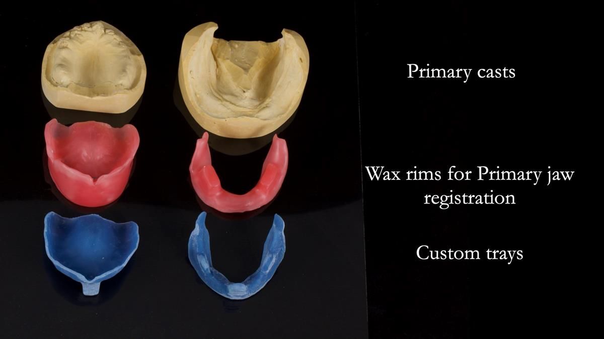 Fin’s Newsletter 88 — Complete dentures - full protocol… he rearranged his own teeth!