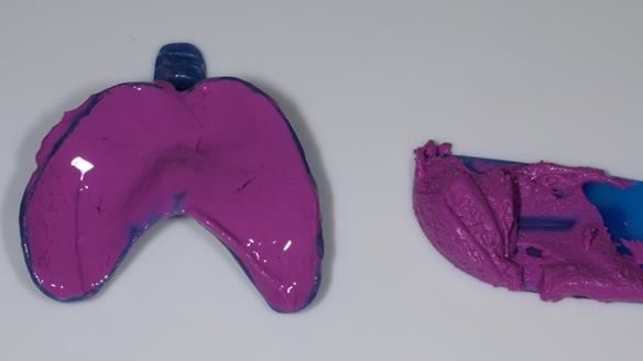 Newsletter 79 – Creating a wonderful smile and changing a life.