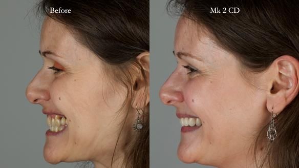 Newsletter 79 – Creating a wonderful smile and changing a life.