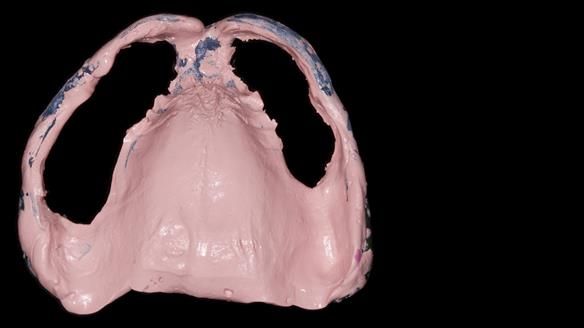 Newsletter 79 – Creating a wonderful smile and changing a life.