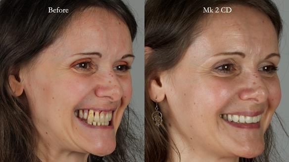 Newsletter 79 – Creating a wonderful smile and changing a life.