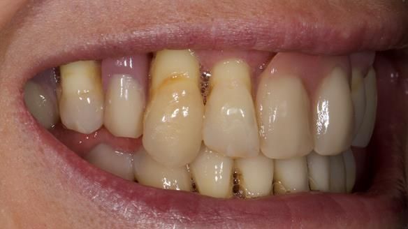 Newsletter 79 – Creating a wonderful smile and changing a life.