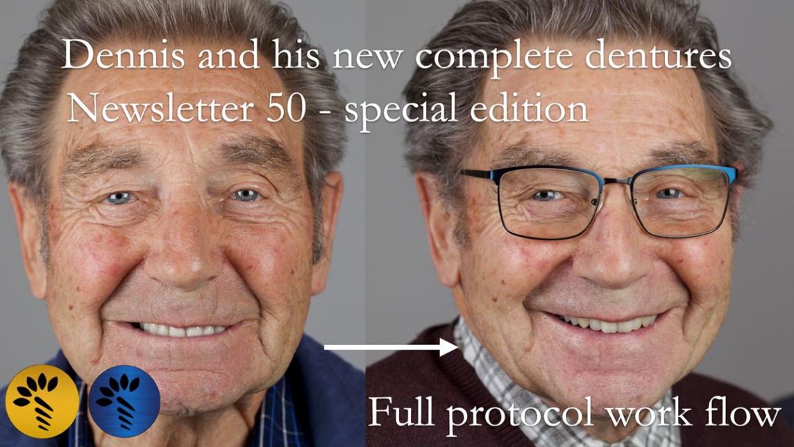 Newsletter 50 Special edition Complete Dentures FULL PROTOCOL
