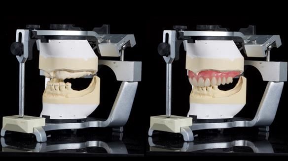 Newsletter 79 – Creating a wonderful smile and changing a life.