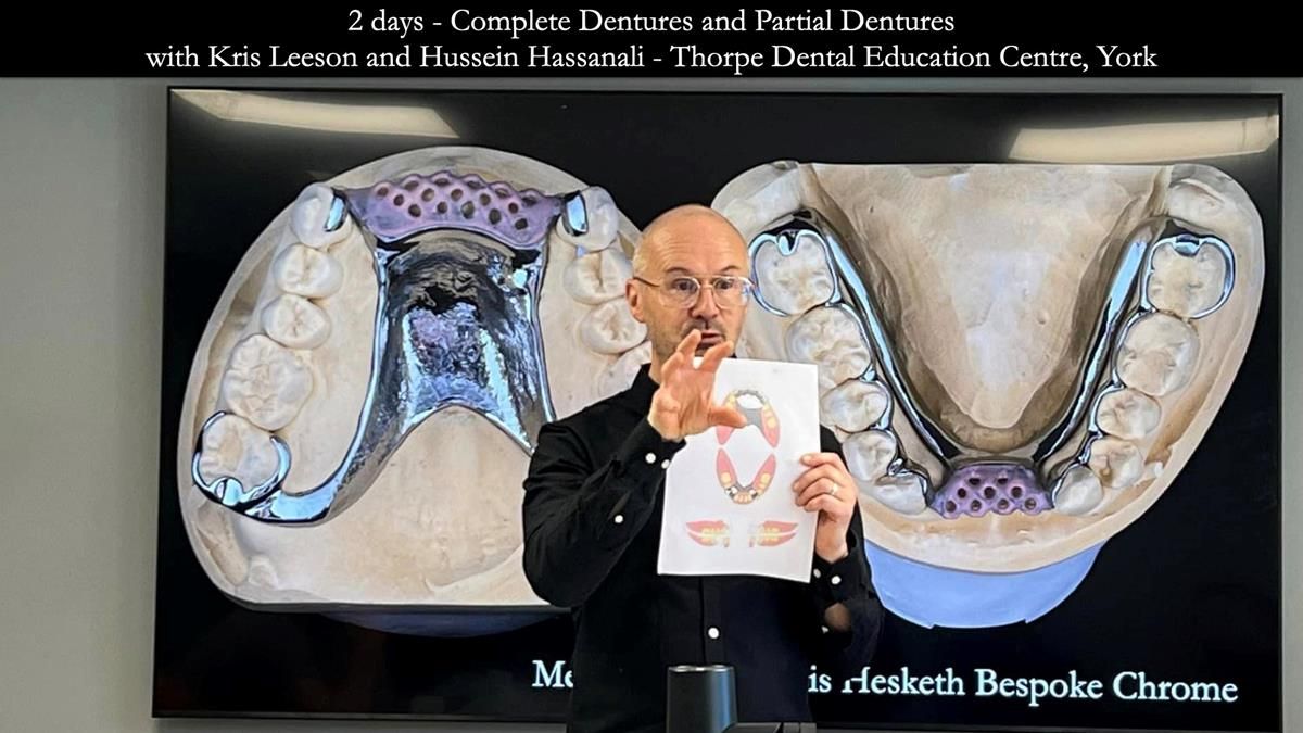 Finlay's Newsletter 59 Ultra hard partial dentures made for Gill