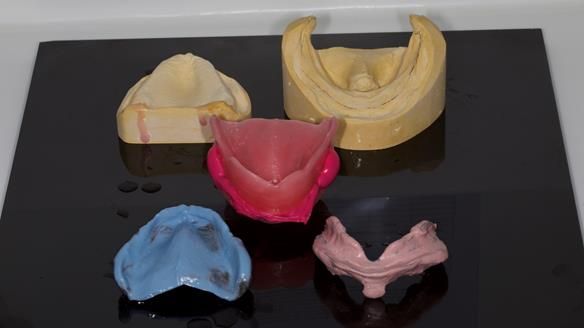 Newsletter 80 - Gordon’s dentures: the one case in 1,000 where my technique failed