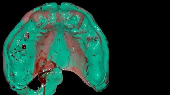 Newsletter 79 – Creating a wonderful smile and changing a life.