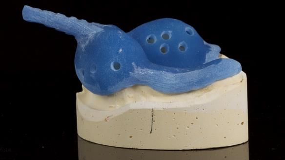 Newsletter 86 Peter the Architect — precision removable partial dentures case study