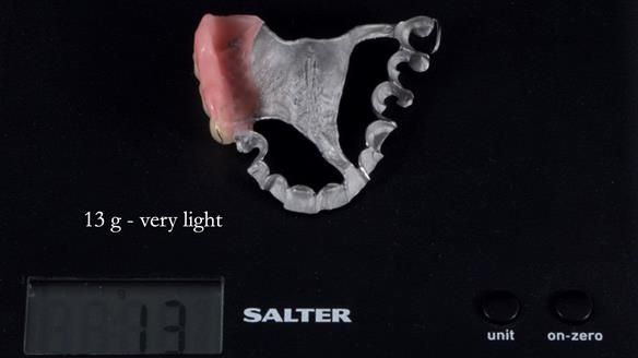 Finlay's Newsletter 64 case study - provision of a Kennedy class 2 metal based Scandinavian RPD for Ian