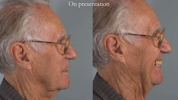 Ken – going downhill, first class