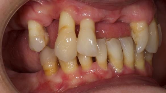 Newsletter 79 – Creating a wonderful smile and changing a life.