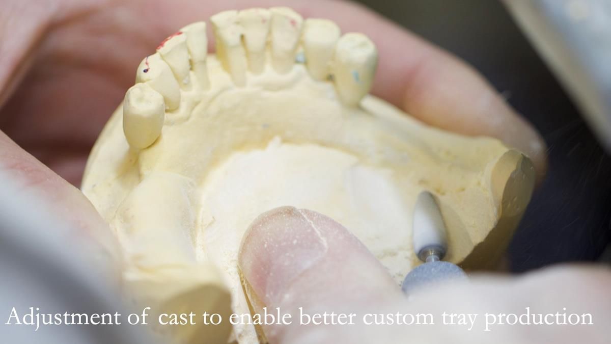Newsletter 87 – Father Peter: A Partial Denture that needed Minor Miracle