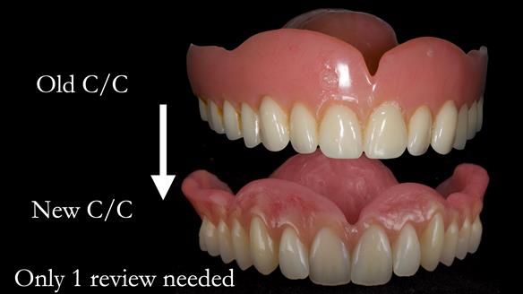 Newsletter 48 Mavis's Complete denture FULL PROTOCOL