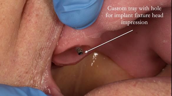 Ken – going downhill, first class