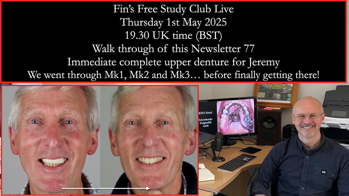 Newsletter 77: Jeremy’s case – immediate complete upper denture
