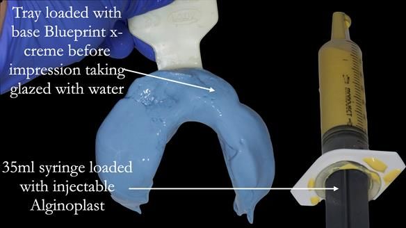Newsletter 80 - Gordon’s dentures: the one case in 1,000 where my technique failed