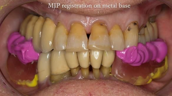 Ken – going downhill, first class