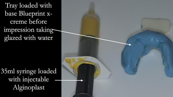 Newsletter 53 showing the making and fitting of ultra life-like dentures for Valena