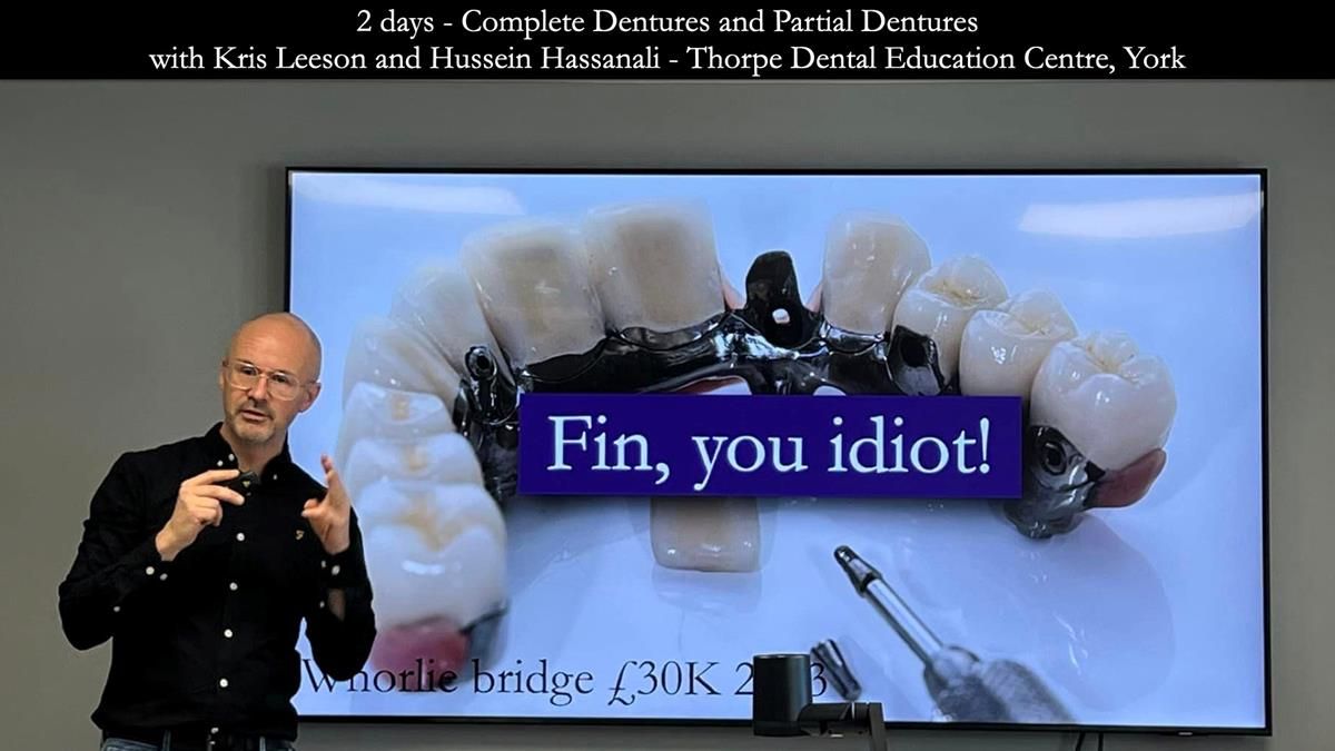 Finlay's Newsletter 59 Ultra hard partial dentures made for Gill