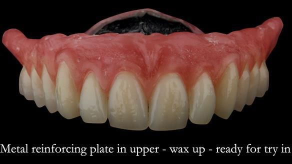 Wax try in ready for visit 4.