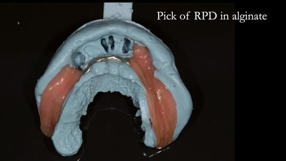 Ken – going downhill, first class